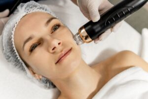 Woman relaxing while undergoing microneedling treatment