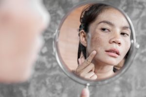 a person examining sun spots on their face in a small mirror