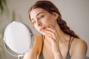 Woman with acne looking at herself in mirror